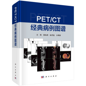 PET/CT (jng)䲡DV