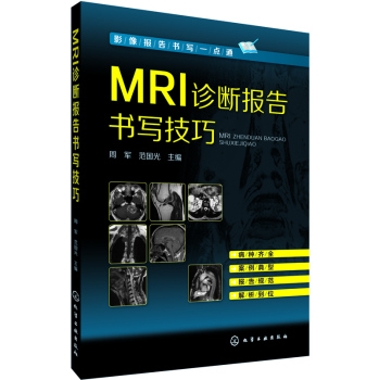 MRI\