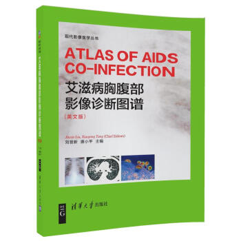 ̲ظӰ\DV ( ATLAS OF AIDS CO-INFECTION) (Ӣİ)F(xin)Ӱt(y)W(xu)