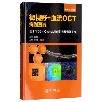 ΢ҕҰ+Ѫ��OCT�����D�V������NIDEK OVERLAY�����Զ�ģӰ��ƽ�_